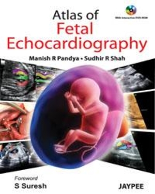 Atlas of Fetal Echocardiography - Manish R Pandya