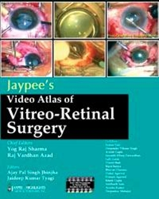 Jaypee's Video Atlas of Vitreo-Retinal Surgery - Yog Raj Sharma, Raj V Azad