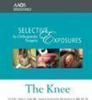 Selective Exposures in Orthopaedic Surgery - 