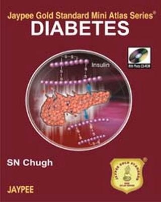 Jaypee Gold Standard Mini Atlas Series: Diabetes - SN Chugh