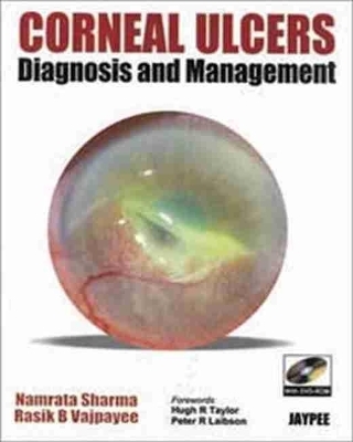 Corneal Ulcers Diagnosis and Management - Namrata Sharma, Rasik B Vajpayee