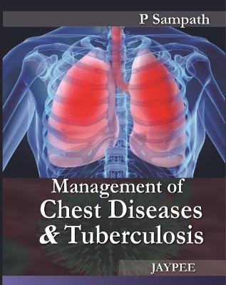 Management of Chest Diseases and Tuberculosis - P Sampath