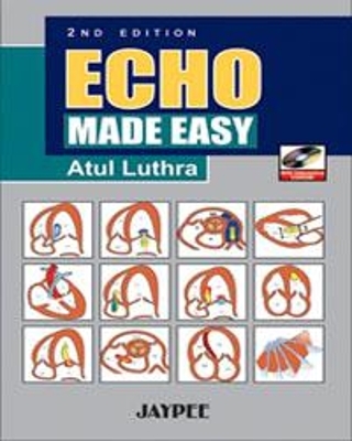 Echo Made Easy - Atul Luthra