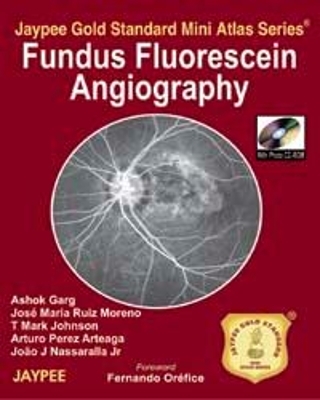 Jaypee Gold Standard Mini Atlas Series: Fundus Fluorescein Angiography - Ashok Garg, Jose Maria Ruiz Moreno, T Mark Johnson, Arturo Perez Arteaga, Joao J Nassaralla