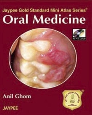 Jaypee Gold Standard Mini Atlas Series: Oral Medicine - Anil Ghom