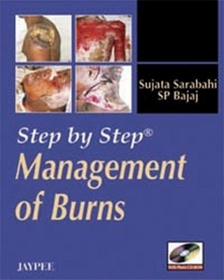 Step by Step: Management of Burns - Sujata Sarabahi, SP Bajaj