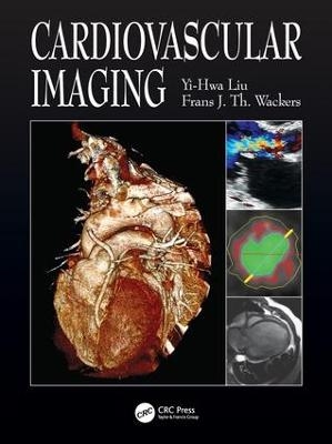 Cardiovascular Imaging - Yi-Hwa Liu, Frans Wackers