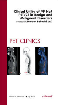 Clinical Utility of 18NaF PET/CT in Benign and Malignant Disorders, An Issue of PET Clinics - Mohsen Beheshti