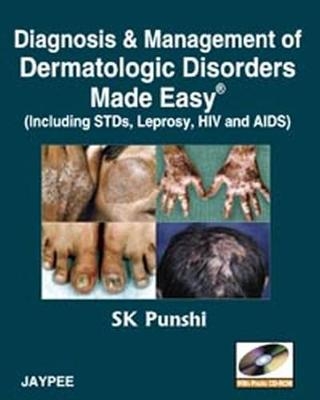 Diagnosis and Management of Dermatologic Disorders Made Easy - SK Punshi