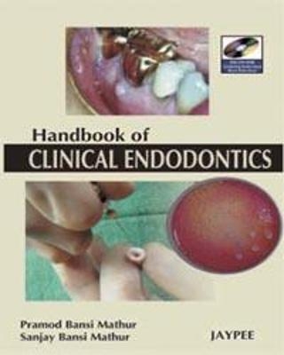 A Hand Book of Clinical Endodontics - Pramod Bansi Mathur, Sanjay Bansi Mathur