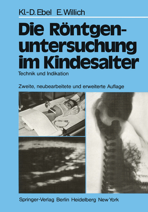 Die Röntgenuntersuchung im Kindesalter - Klaus-D. Ebel, Eberhard Willich