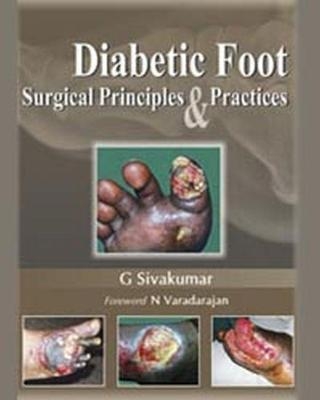 Diabetic Foot - G Sivakumar