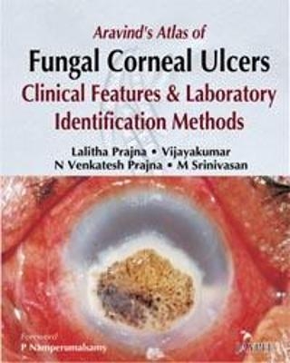 Aravind's Atlas of Fungal Corneal Ulcers - Lalitha Prajna,  Vijayakumar, N Venkatesh Prajina, M Srinivasan