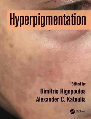 Hyperpigmentation - 