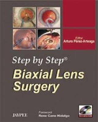 Step by Step: Biaxial Lens Surgery - Arturo Perez Arteaga