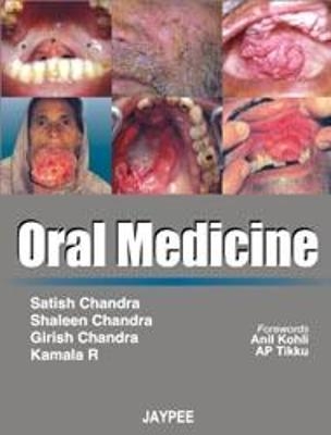 Oral Medicine - Satish Chandra, Shaleen Chandra, Girish Chandra, R Kamala