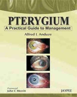 Pterygium - A Practical Guide to Management - Alfred L Anduze