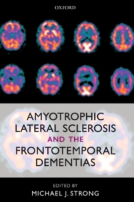 Amyotrophic Lateral Sclerosis and the Frontotemporal Dementias - 