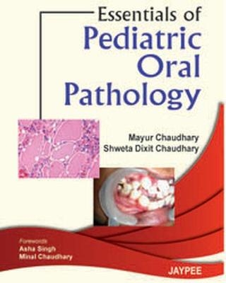 Essentials of Pediatric Oral Pathology - Mayur Chaudhary, Schweta Dixit Chaudhary