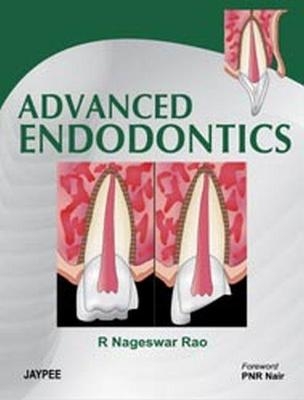 Advanced Endodontics - R Nageswar Rao