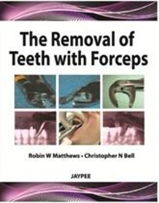 The Removal of Teeth with Forceps - Robin W Matthews, Christopher N Bell