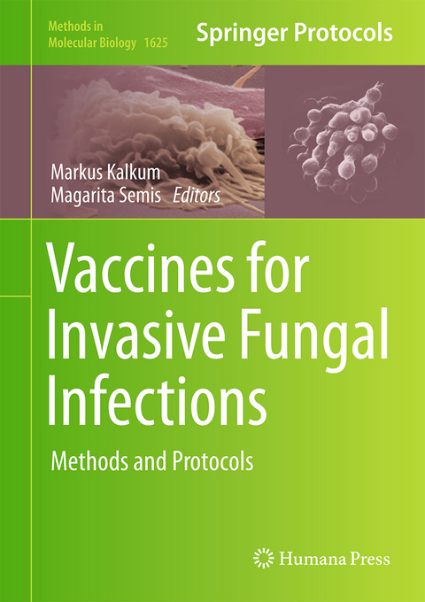 Vaccines for Invasive Fungal Infections - 