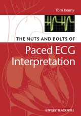 Nuts and bolts of Paced ECG Interpretation -  Tom Kenny