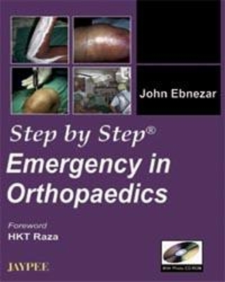 Step by Step: Emergency in Orthopaedics - John Ebnezar