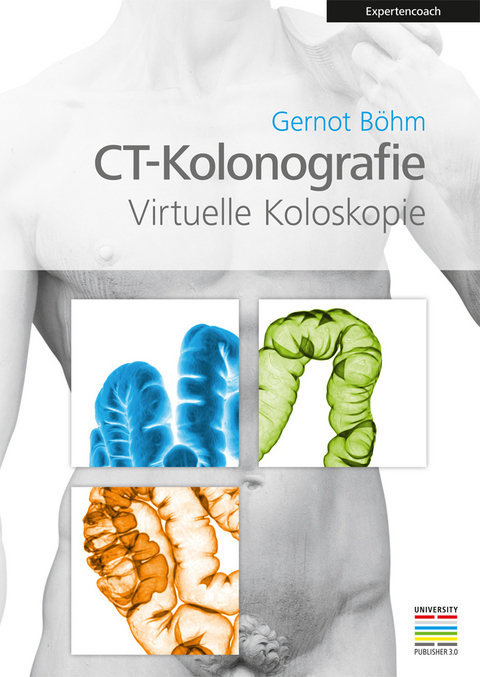 CT-Kolonografie - 