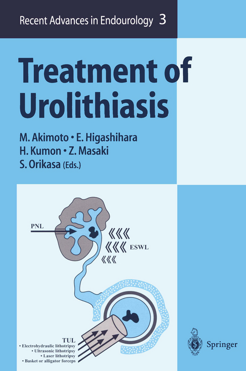 Treatment of Urolithiasis - 