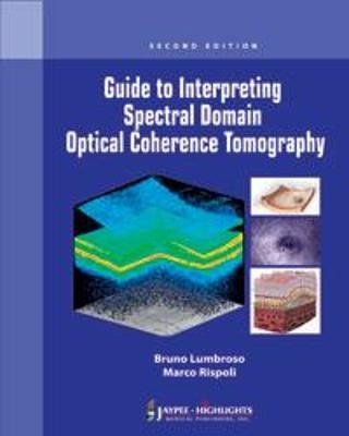 Guide to Interpreting Spectral Domain Optical Coherence Tomography - Bruno Lumbroso, Marco Rispoli