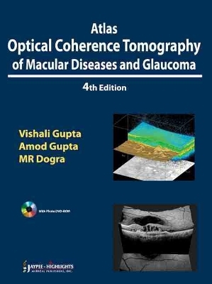 Atlas Optical Coherence Tomography of Macular Diseases and Glaucoma - Vishali Gupta, Amod Gupta, Mangat Ram Dogra