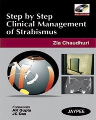 Step by Step: Clinical Management of Strabismus - Zia Chaudhuri