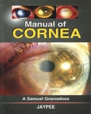Manual of Cornea - A Samuel Gnanadoss