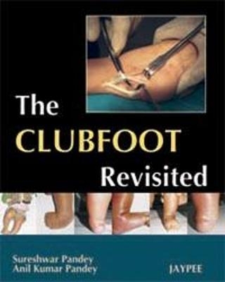 The Club Foot Revisited - Sureshwar Pandey, Anil Kumar Pandey