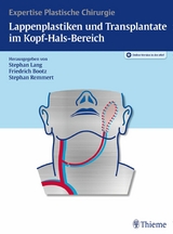 Lappenplastiken und Transplantate im Kopf-Hals-Bereich - 