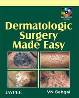 Dermatologic Surgery Made Easy - VN Sehgal