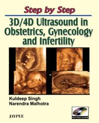 Step by Step: 3D and 4D Ultrasound in Obstetrics, Gynecology and Infertility - Kuldeep Singh, Narendra Malhotra