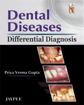 Dental Diseases (Differential Diagnosis) - Priya Verma Gupta