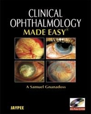 Clinical Ophthalmology Made Easy - Anina Abraham, Sirisha Senthil