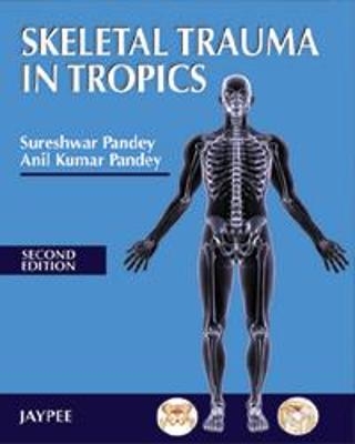 Skeletal Trauma in Tropics - Sureshwar Pandey