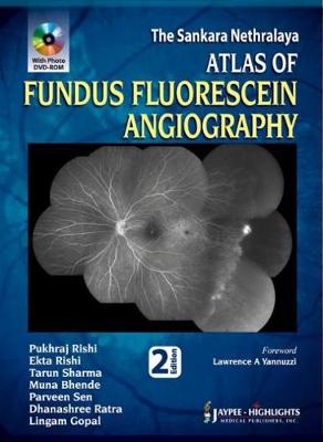 Atlas of Fundus Fluorescein Angiography - Pukhraj Rishi, Ekta Rishi, Tarun Sharma, Muna Bhende, Parveen Sen