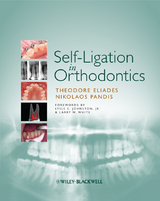 Self-Ligation in Orthodontics -  Theodore Eliades,  Nikolaos Pandis