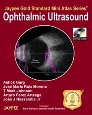 Jaypee Gold Standard Mini Atlas Series: Ophthalmic Ultrasound - Ashok Garg, Jose Maria Ruiz Moreno, T Mark Johnson, Arturo Perez Arteaga, Joao J Nassaralla