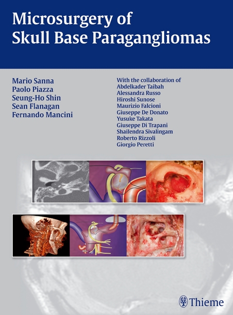Microsurgery of Skull Base Paragangliomas - Mario Sanna, Paolo Piazza, Seung-Ho Shin, Sean Flanagan, Fernando Mancini