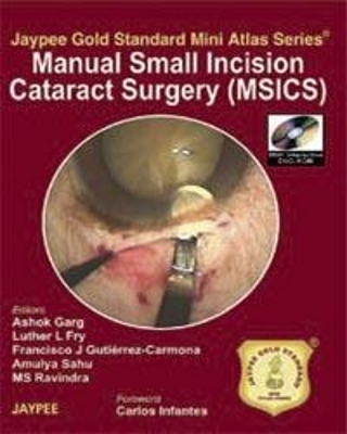 Jaypee Gold Standard Mini Atlas Series: Manual Small Incision Cataract Surgery (MSICS) - Ashok Garg, Luther L Fry, Amulya Sahu, Francisco J Gutierrez-Carmona, MS Ravindra