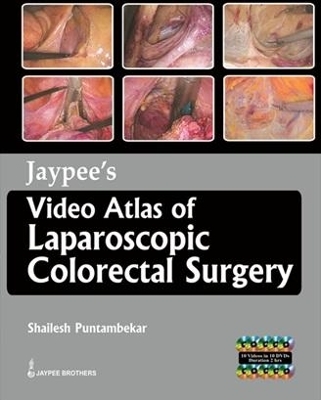 Jaypee's Video Atlas of  Laparoscopic Colorectal Surgery - Shailesh Puntambekar