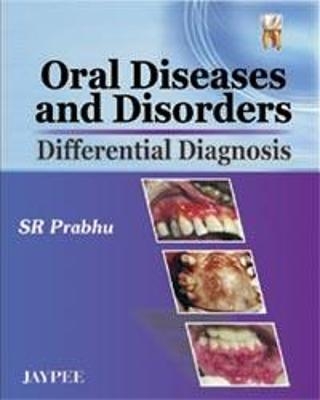 Oral Diseases and Disorders - S R Prabhu