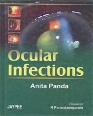 Ocular Infection - Anita Panda