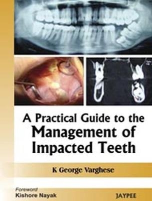 A Practical Guide to the Management of Impacted Teeth - George K Varghese